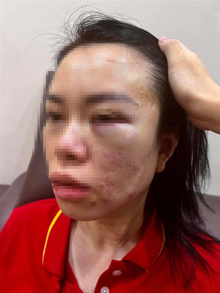 Người phụ nữ ở Hà Nội tố chồng cũ bắt nhốt trên ô tô, đánh đập hơn 1 ngày: Công an vào cuộc-1
