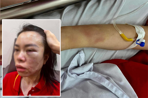 Bắt người đàn ông ép vợ cũ lên ôtô rồi đánh đập dã man suốt gần một ngày đêm-2