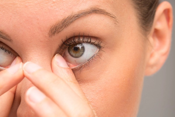 Nhiều người làm động tác này để giảm mỏi mắt mà không biết có thể gây biến dạng nhãn cầu-2