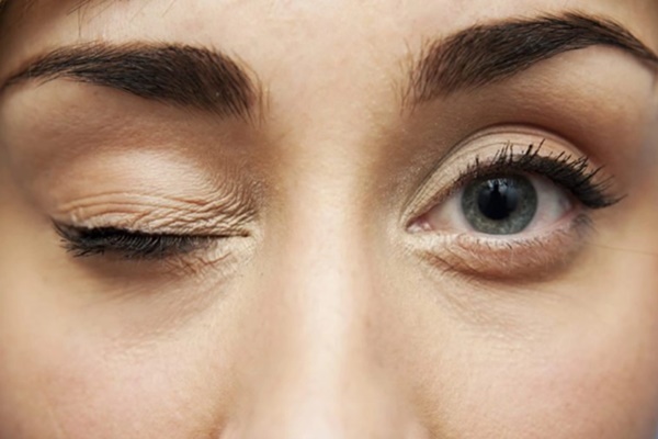 Nhiều người làm động tác này để giảm mỏi mắt mà không biết có thể gây biến dạng nhãn cầu-4