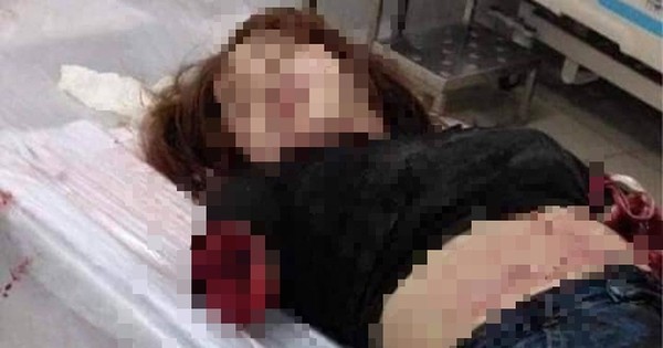 Ớn lạnh, chồng nhẫn tâm chém đứt 2 cánh tay vợ-1