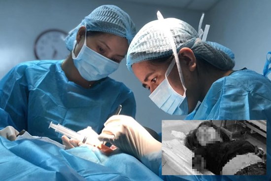 Ớn lạnh, chồng nhẫn tâm chém đứt 2 cánh tay vợ