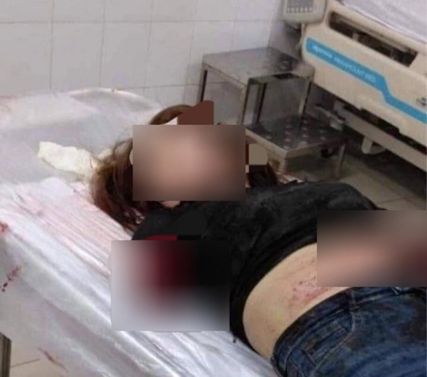 Tạm giữ hình sự người chồng chém đứt lìa 2 cánh tay vợ ở Đồng Nai-1