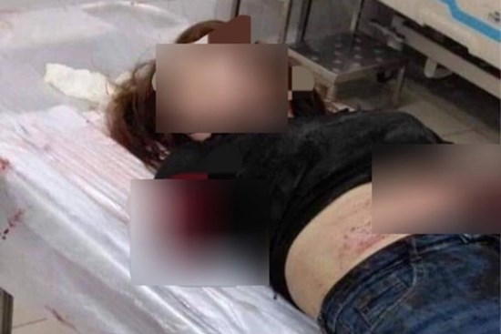 Tạm giữ hình sự người chồng chém đứt lìa 2 cánh tay vợ ở Đồng Nai