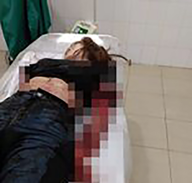 Chém đứt lìa 2 cánh tay vợ do bị người tình của vợ khiêu khích, kích động?-1