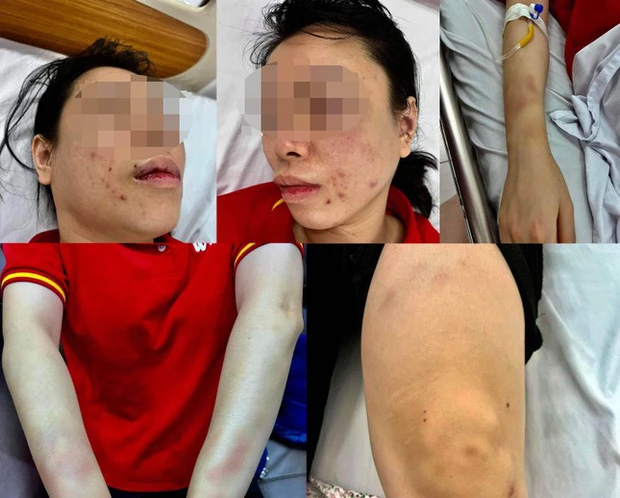 Vụ người phụ nữ ở Hà Nội tố bị bắt cóc, đánh đập dã man: Chồng cũ nạn nhân khai nhận hành vi-2