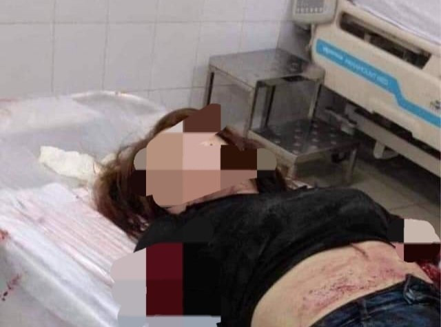 Chém lìa tay vợ vì ghen, làm rõ chuyện ngoại tình có thay đổi tội danh?-1