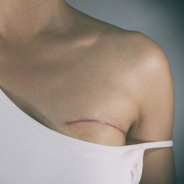 Có 7 yếu tố này trong cuộc sống, bạn có nguy cơ bị ung thư vú cao hơn-6