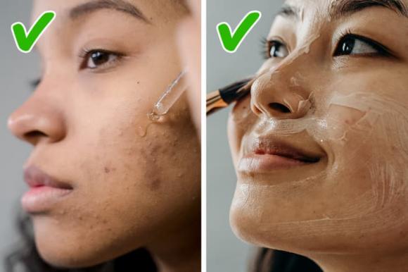 Làm thế nào để thoát khỏi mụn đầu đen ở cằm một lần và mãi mãi-4