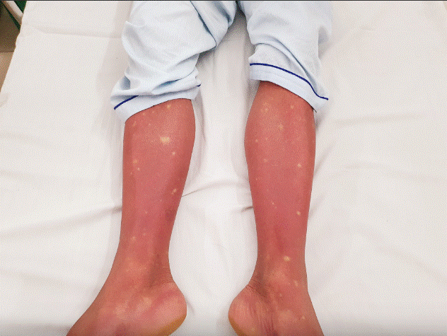 Ngoài Adeno virus, đây là bệnh dịch đang tăng chóng mặt tại Hà Nội-3