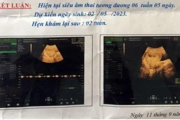 Mẹ mang gen bệnh Thalassemia nhưng bố bình thường, con sinh ra có làm sao không?-2