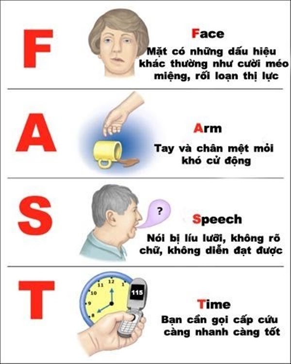 33 tuổi đã bị đột quỵ, những việc nên và không nên làm khi bị đột quỵ-1