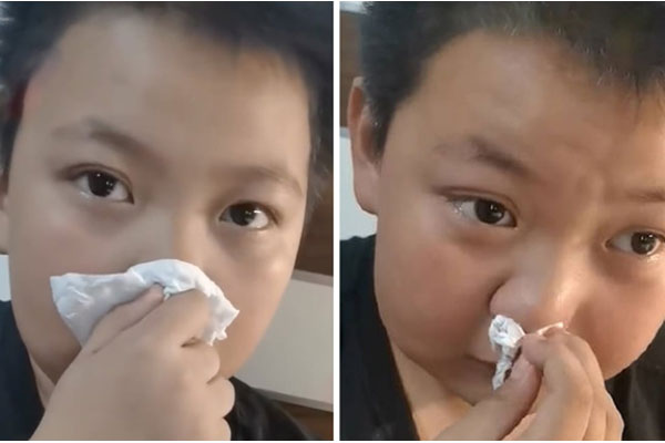 Cậu bé 11 tuổi rơi nước mắt vì dị ứng với mùi bài tập về nhà-1