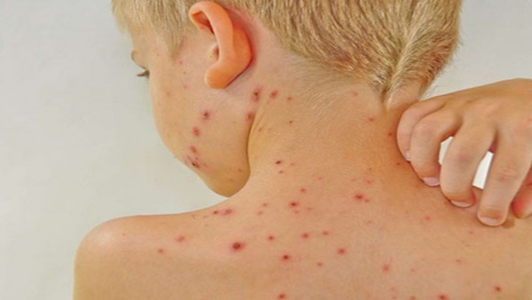 10 dấu hiệu sớm của bệnh suy thận-4