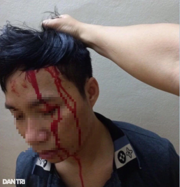 Con trai mua tiết lợn dàn dựng bị bắt cóc để tống tiền mẹ-1