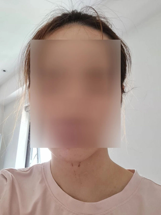 Công an phục hồi giải quyết vụ hoa khôi tố trưởng khoa đại học xâm hại tình dục-2