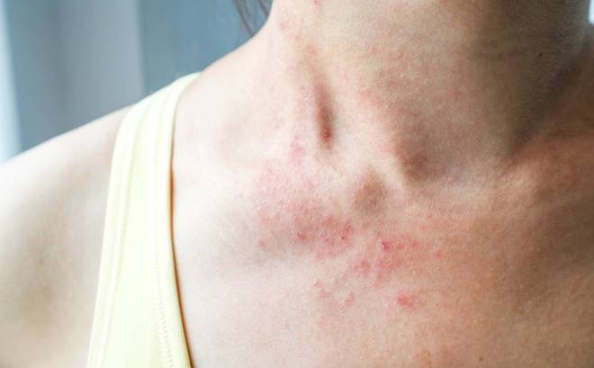 Dấu hiệu trên cơ thể nếu có chớ chủ quan-1