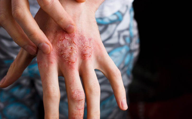 Hơn 5 triệu người Việt mắc tiểu đường: 5 dấu hiệu chứng tỏ đường huyết đang tăng-4