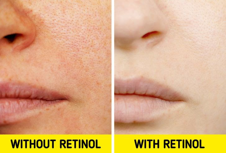 7 thói quen hằng ngày khiến lỗ chân lông của bạn luôn bít tắc-1