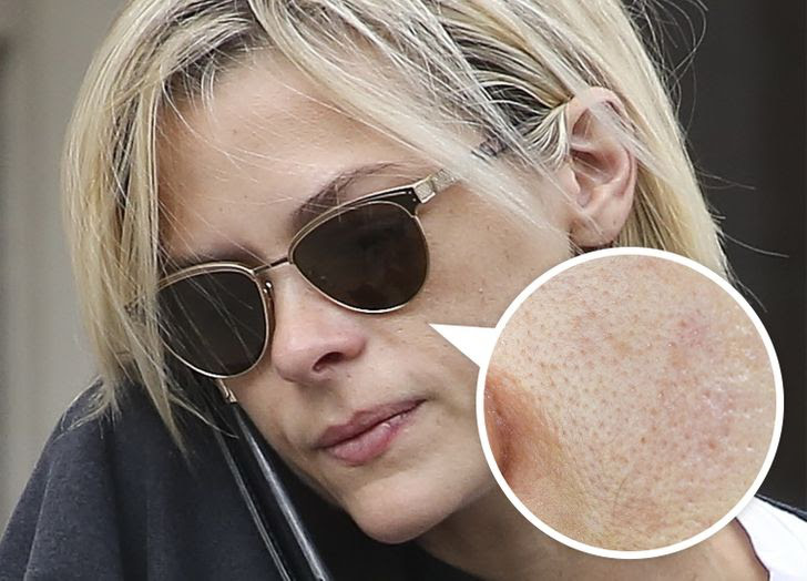 7 thói quen hằng ngày khiến lỗ chân lông của bạn luôn bít tắc-2