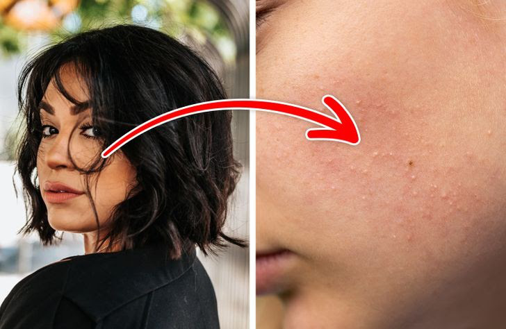 7 thói quen hằng ngày khiến lỗ chân lông của bạn luôn bít tắc-6