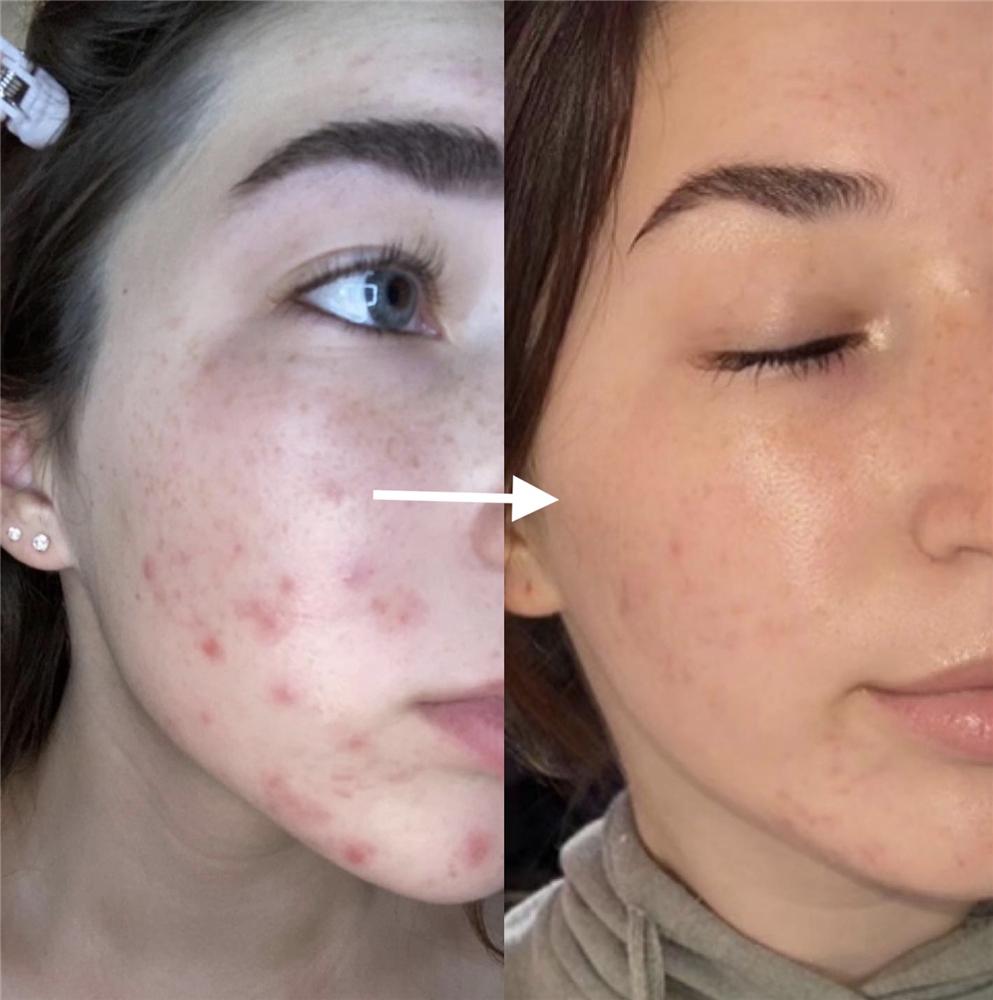 Thành phần giúp làm dịu kích ứng khi dùng Retinol-1