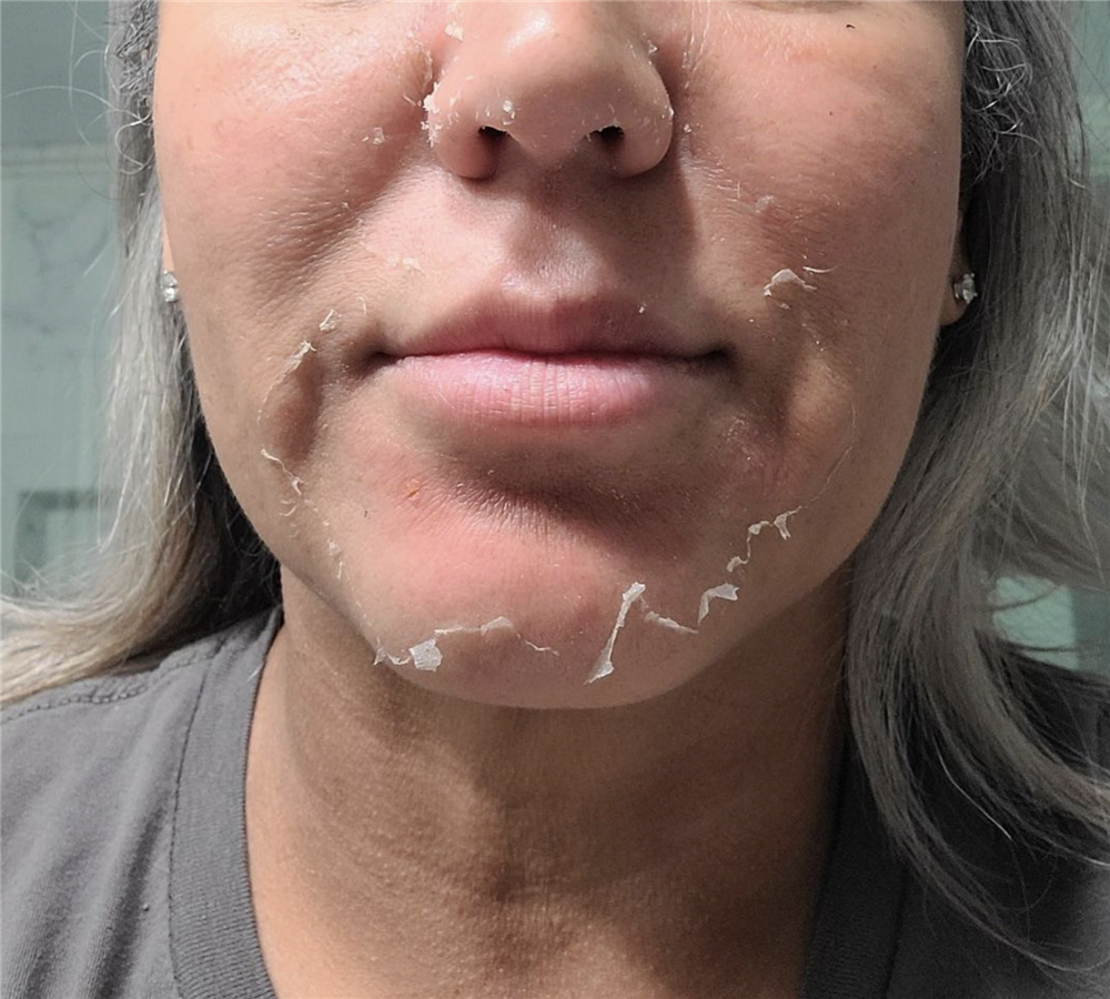 Thành phần giúp làm dịu kích ứng khi dùng Retinol-2