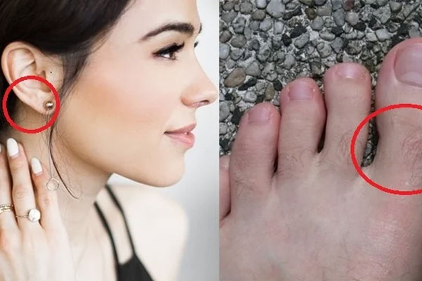 10 nốt ruồi may mắn nhất, chỉ cần nhìn thoáng qua là bạn có thể biết được-6