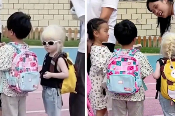 Cô bé bạch tạng khiến hàng triệu người Trung Quốc xúc động-1