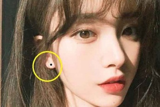 10 nốt ruồi may mắn nhất, chỉ cần nhìn thoáng qua là bạn có thể biết được