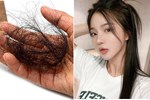 'Mùa rụng tóc' phải làm thế nào để tránh tóc rụng lả tả, xác xơ