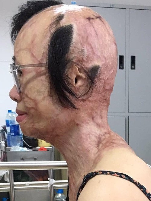 Nữ giáo viên sống sót sau cơn cuồng ghen của chồng: Ám ảnh lạnh người-1