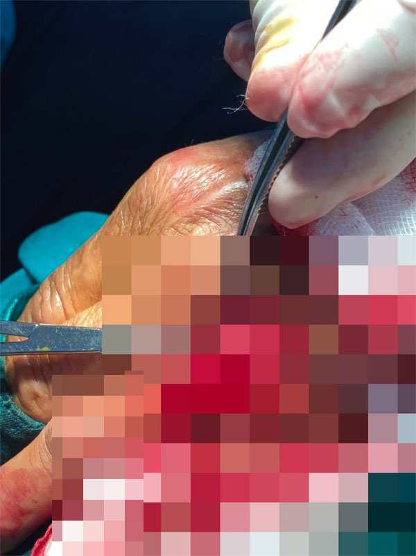 Đi nhắc nợ, nhân viên điện lực ở TP.HCM bị khách hàng đánh nhập viện-1