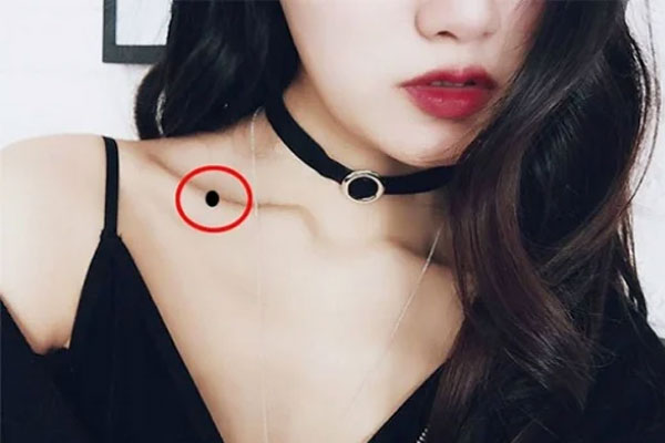 9 nốt ruồi trên mặt quý hơn vàng mười, sở hữu 1/9 cũng đủ may mắn, nhiều người chê xấu lại xóa đi-1