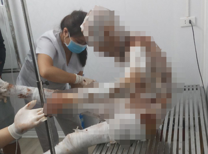 Vợ tẩm xăng đốt chồng vì đi nhậu về khuya-1