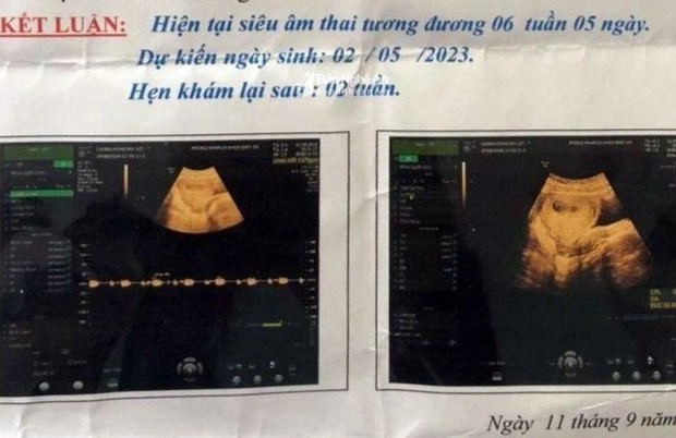 Vụ nữ sinh lớp 6 nghi bị xâm hại dẫn đến mang thai: Nghi phạm đã tử vong-1