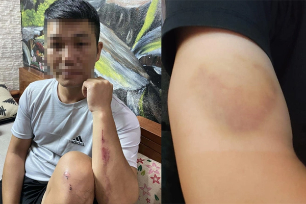 Lý lịch bất hảo của đối tượng dùng vỏ chai bia tấn công người đi đường ở Hà Nội-2