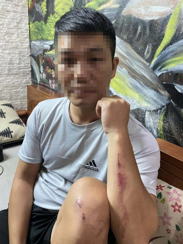 Nhiều người đi đường ở Hà Nội bị tấn công bằng vỏ chai-1