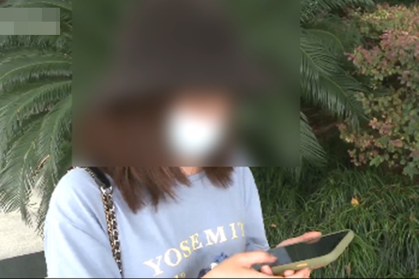 Dù nguy hiểm đến tính mạng, cô gái vẫn tiêm filler môi 32 lần-3