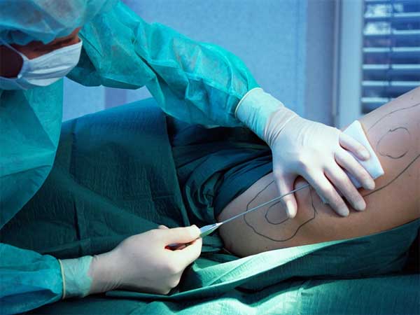 Bé gái hút mỡ năm 7 tuổi vì tiêu chuẩn sắc đẹp độc hại-3