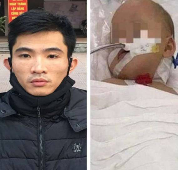 Rùng mình lời kể của cha dượng đóng đinh vào đầu bé 3 tuổi-10