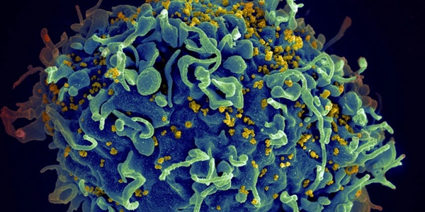Xuất hiện loại virus giống HIV, nguy cơ lây sang người-2