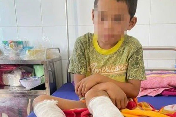 Bé 1 tuổi nguy kịch vì uống nhầm chai xăng để trong tủ lạnh-2
