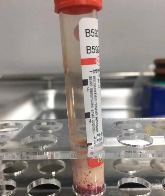 Nữ giáo viên 22 tuổi máu chuyển màu trắng đục, cấp cứu vì 1 thức uống vạn người trẻ đều mê-2