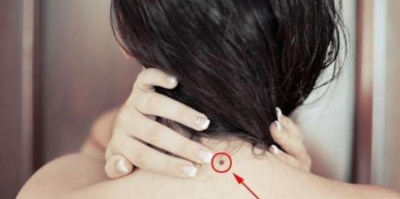 Người có 4 nốt ruồi này gặp nhiều may mắn sung túc nhất đời-4