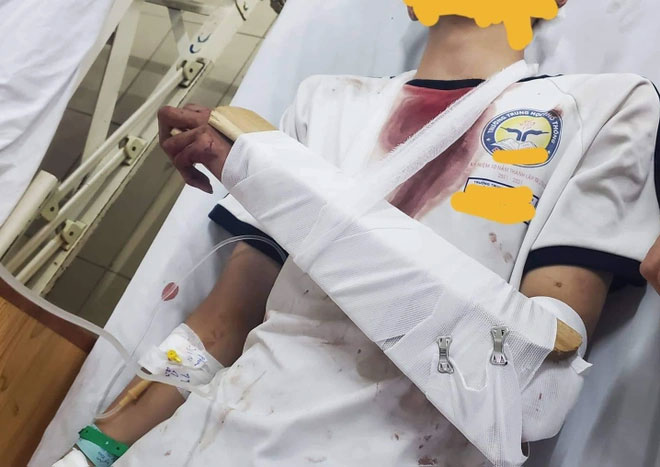 Nam sinh bị chém tới tấp ở TP.HCM-1