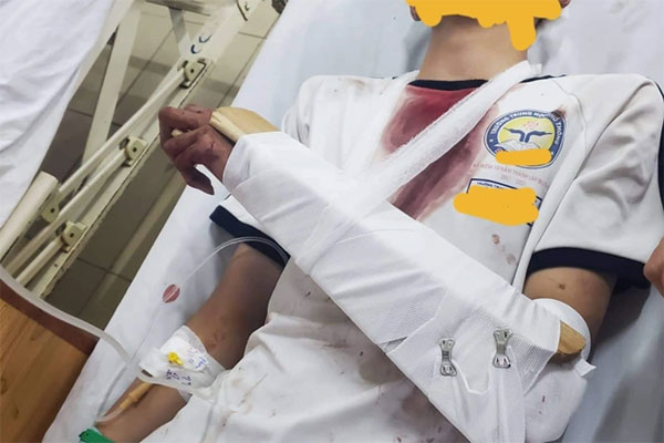 Nam sinh lớp 11 ở Long An bị bạn đánh chết: Thông tin mới nhất-2