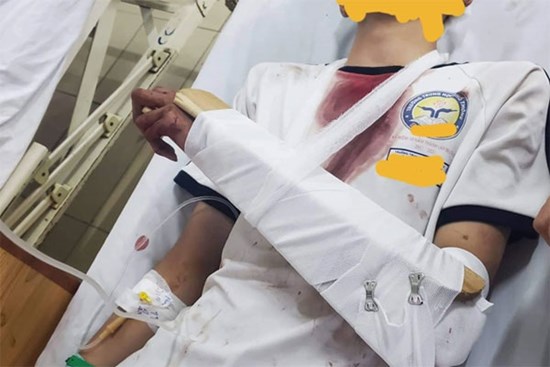 Nam sinh bị chém tới tấp ở TP.HCM