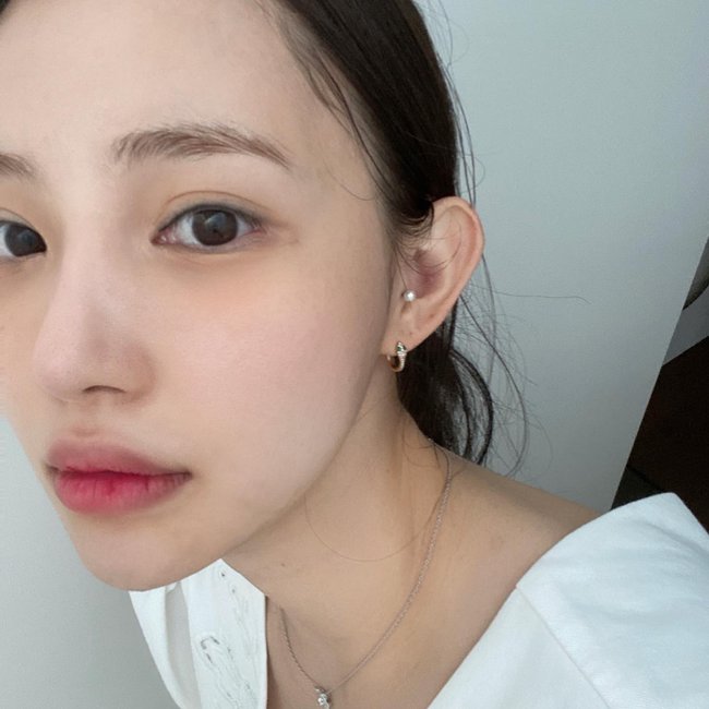 Sẹo rỗ sau mụn: 2 cách đơn giản trị sẹo, tăng sinh collagen được bác sĩ da liễu khuyên dùng-2