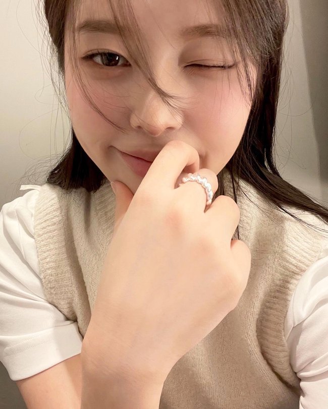 Sẹo rỗ sau mụn: 2 cách đơn giản trị sẹo, tăng sinh collagen được bác sĩ da liễu khuyên dùng-3
